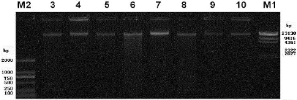 A sputum collection method for the detection of respiratory bacteria 16s rRNA gene sequence