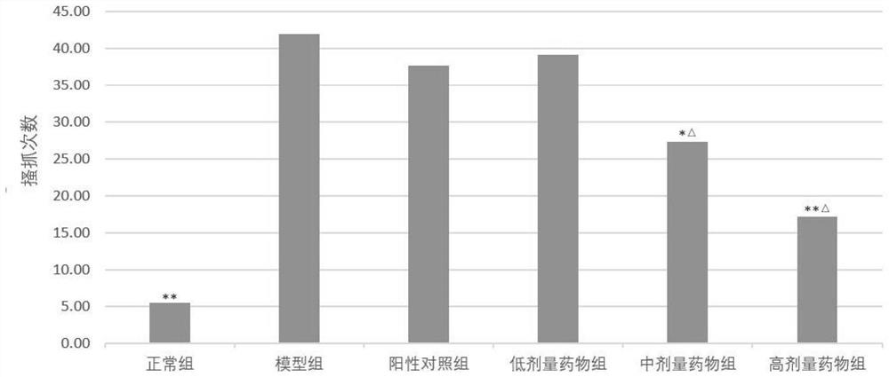 Anti-rhinitis traditional Chinese medicine composition with analgesic effect