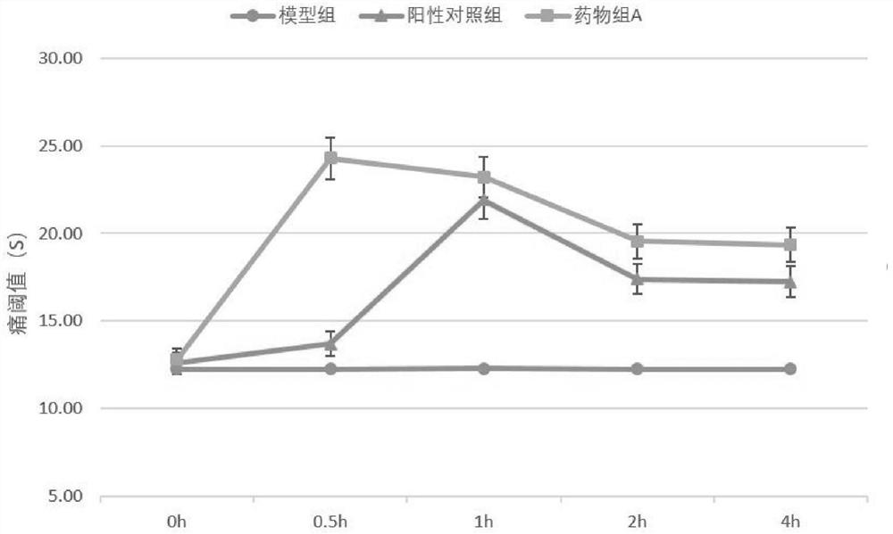 Anti-rhinitis traditional Chinese medicine composition with analgesic effect