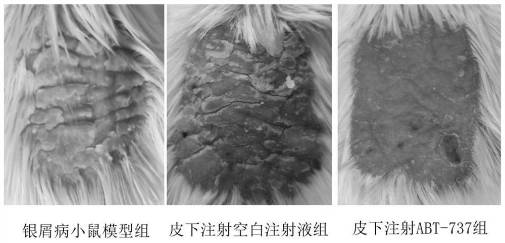 Application of BCL-2 inhibitor and pharmaceutical composition for treating senescence-related skin diseases