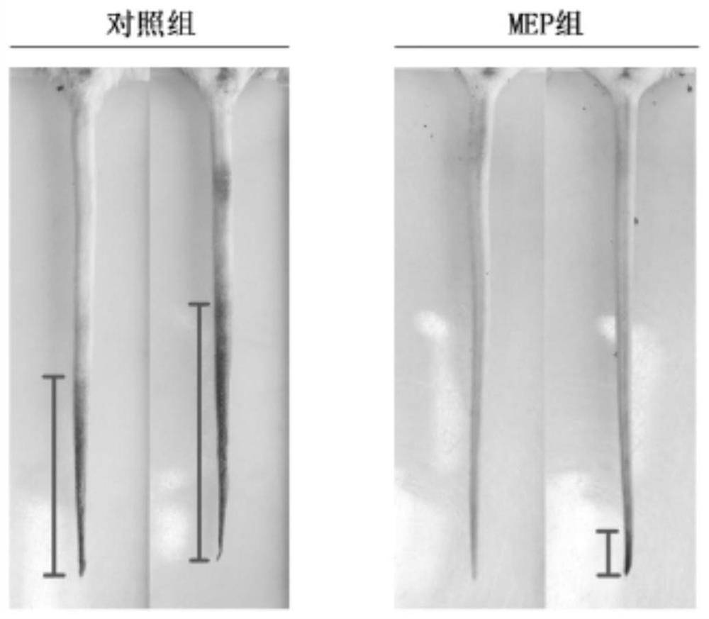 Preparation process of morchella polysaccharide and novel application thereof in prevention and treatment of thrombus and diseases caused by thrombus