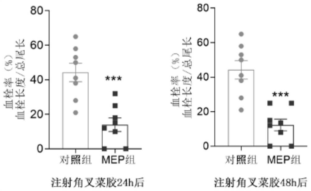 Preparation process of morchella polysaccharide and novel application thereof in prevention and treatment of thrombus and diseases caused by thrombus