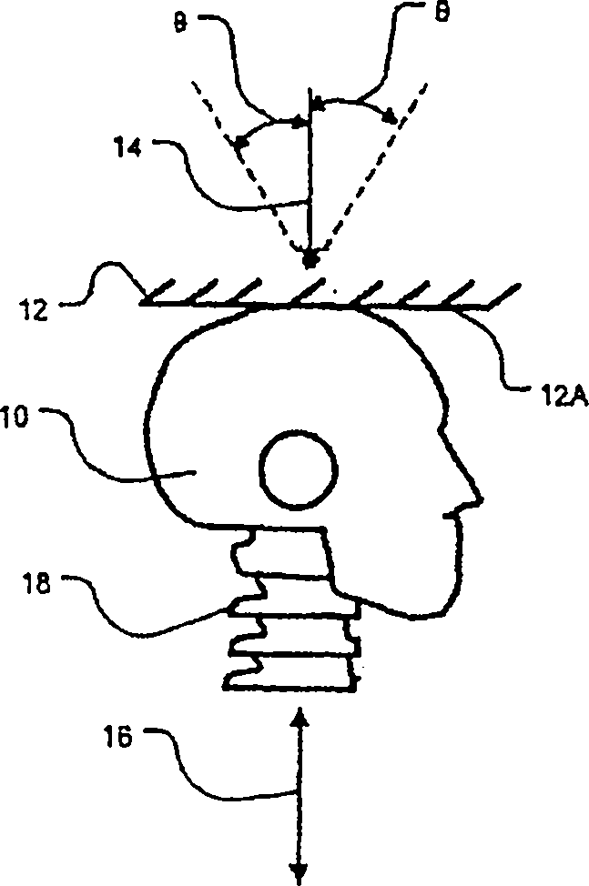 Apparatus for mitigating spinal cord injury