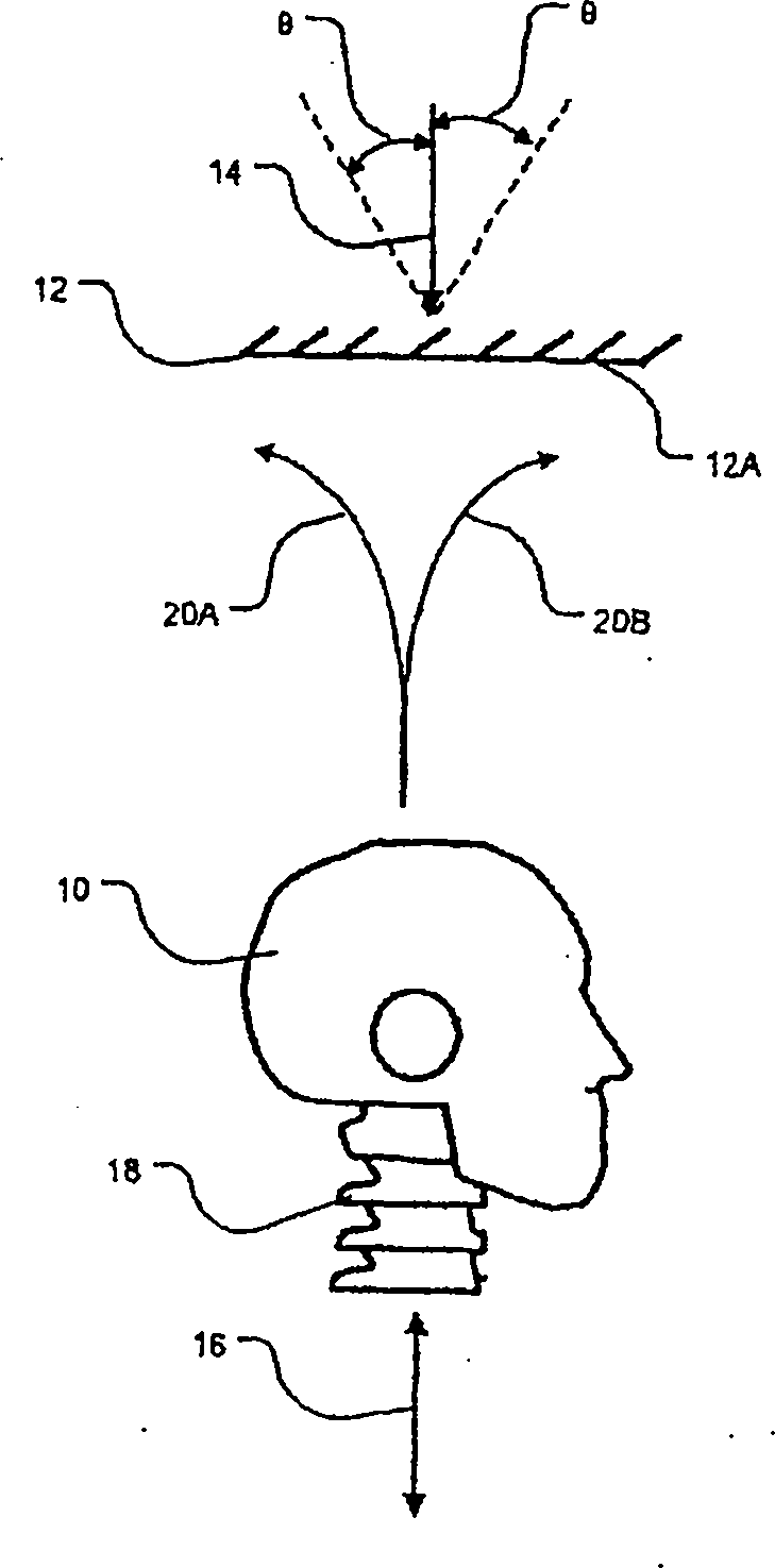 Apparatus for mitigating spinal cord injury