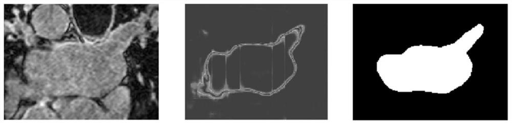 Semi-supervised medical image segmentation method based on geometric consistency constraint