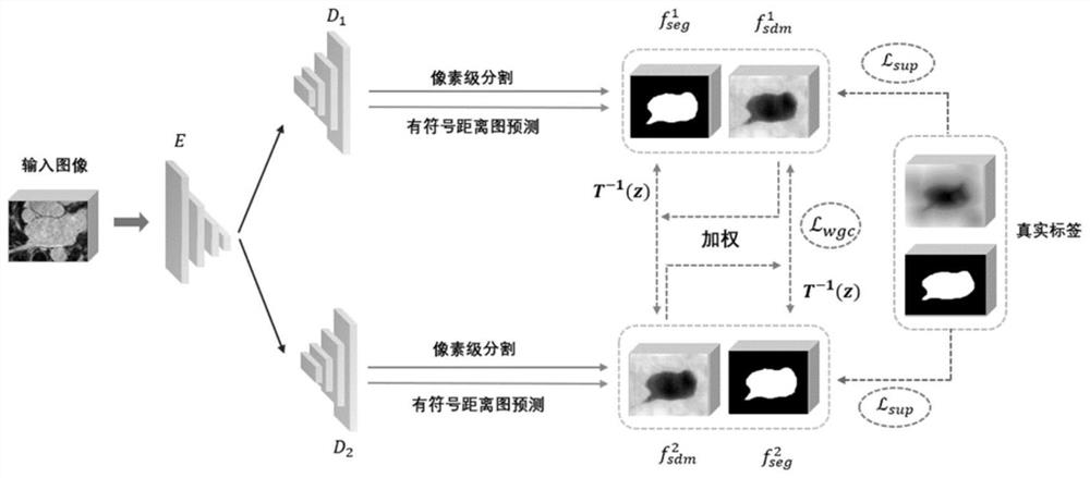 Semi-supervised medical image segmentation method based on geometric consistency constraint