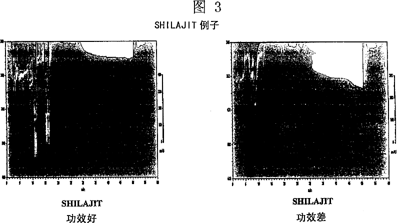 Method of chromatogram fingerprint atlas, single medicine and preparation standardization