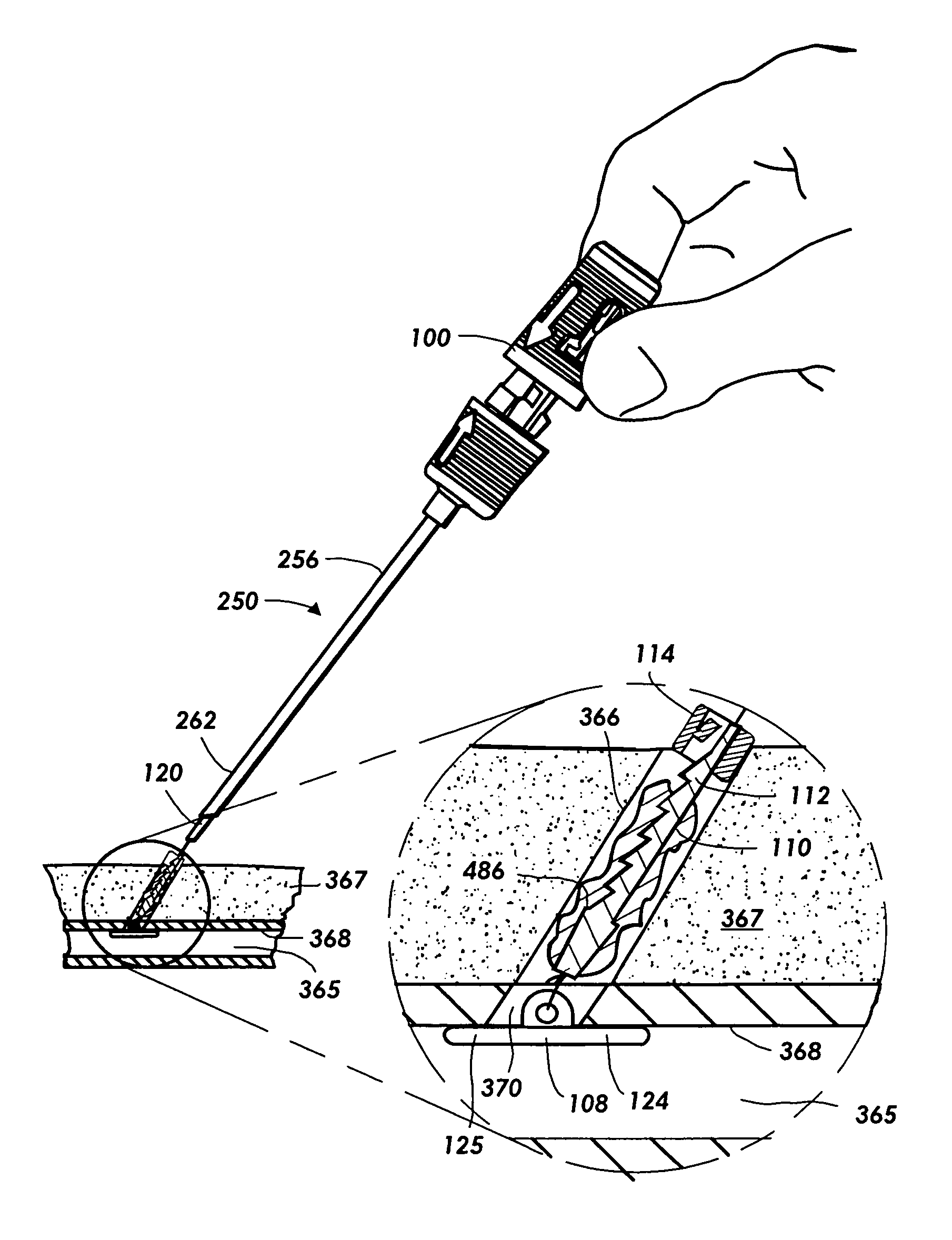 Vascular sealing device with locking hub