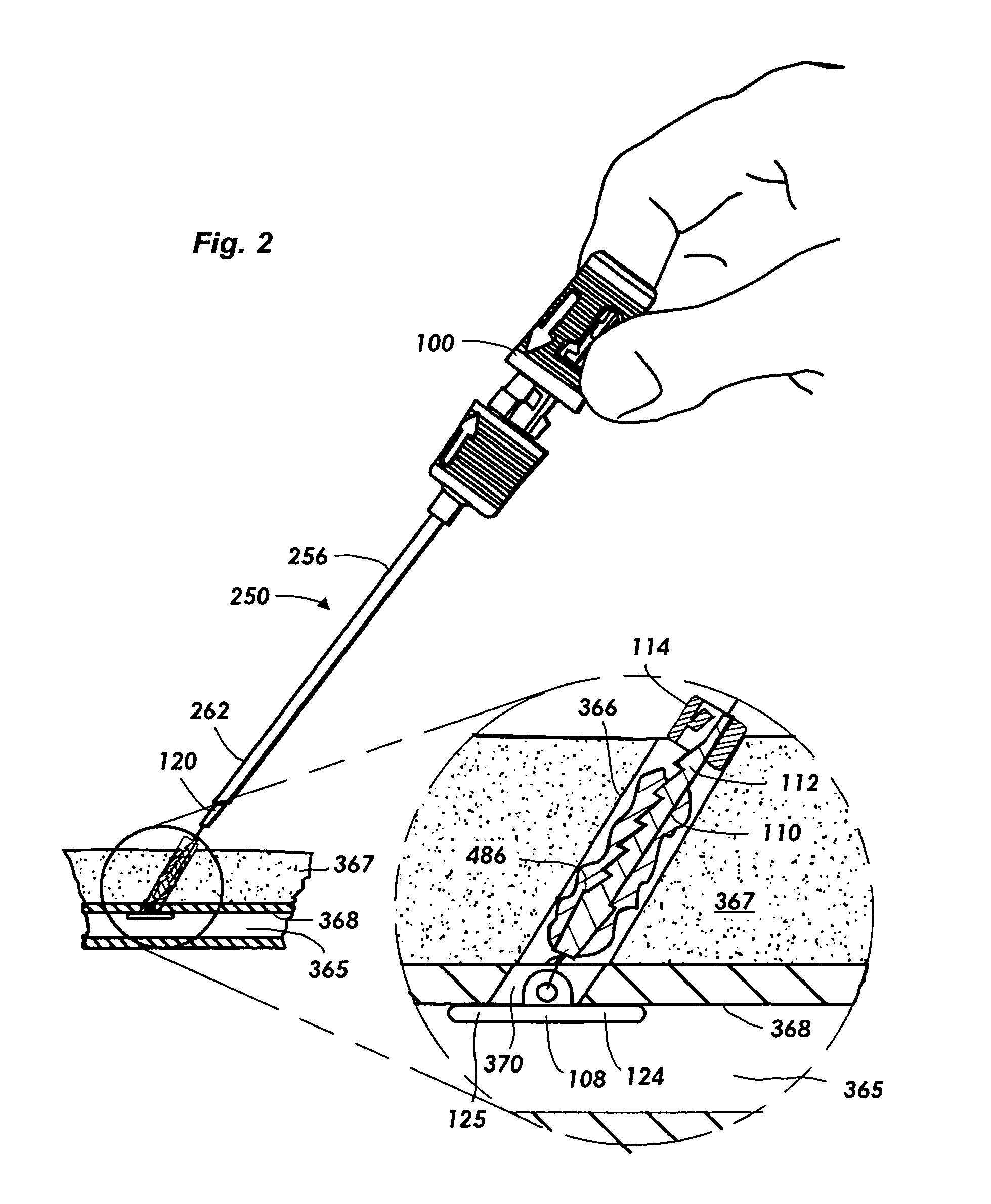 Vascular sealing device with locking hub