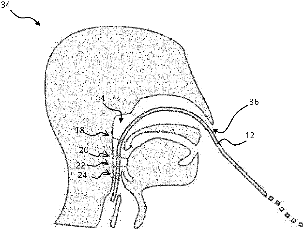 Catheter device