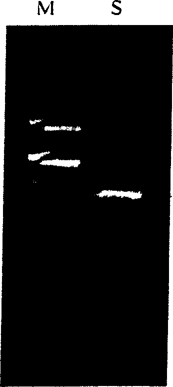 Method for obtaining human copper and zinc superoxide dismutase genes from human body