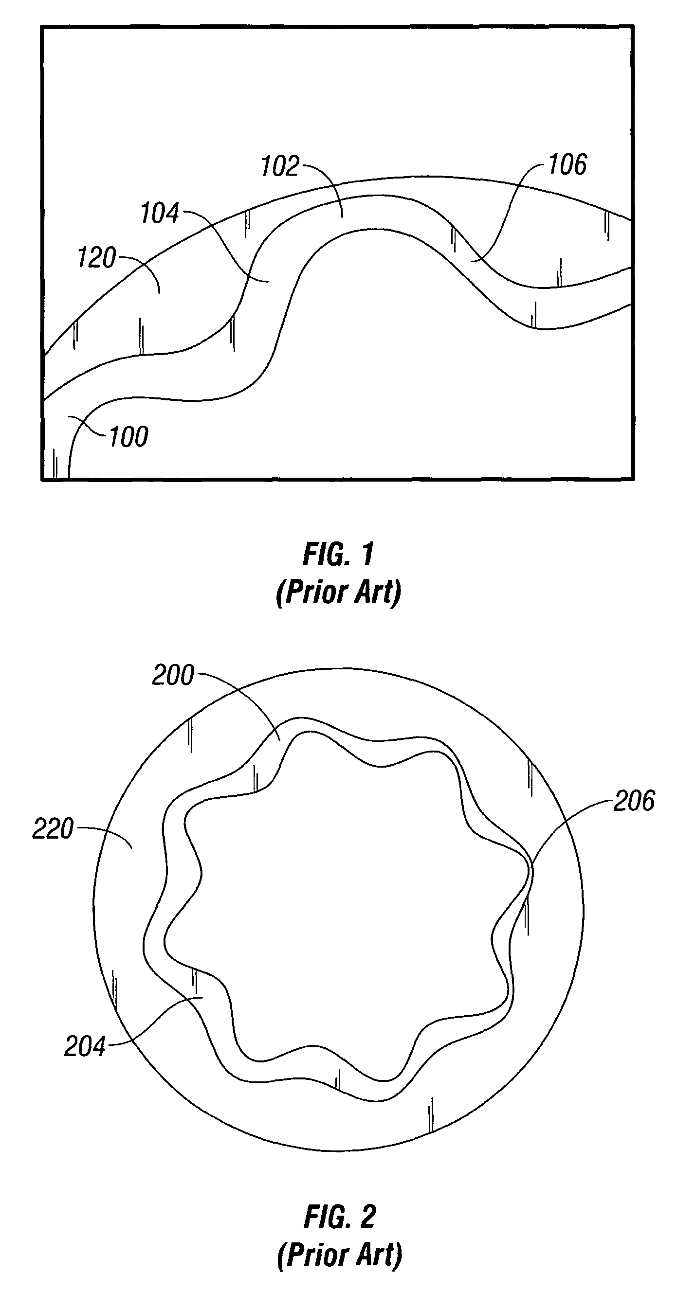 Method of forming controlled thickness resilient material lined stator