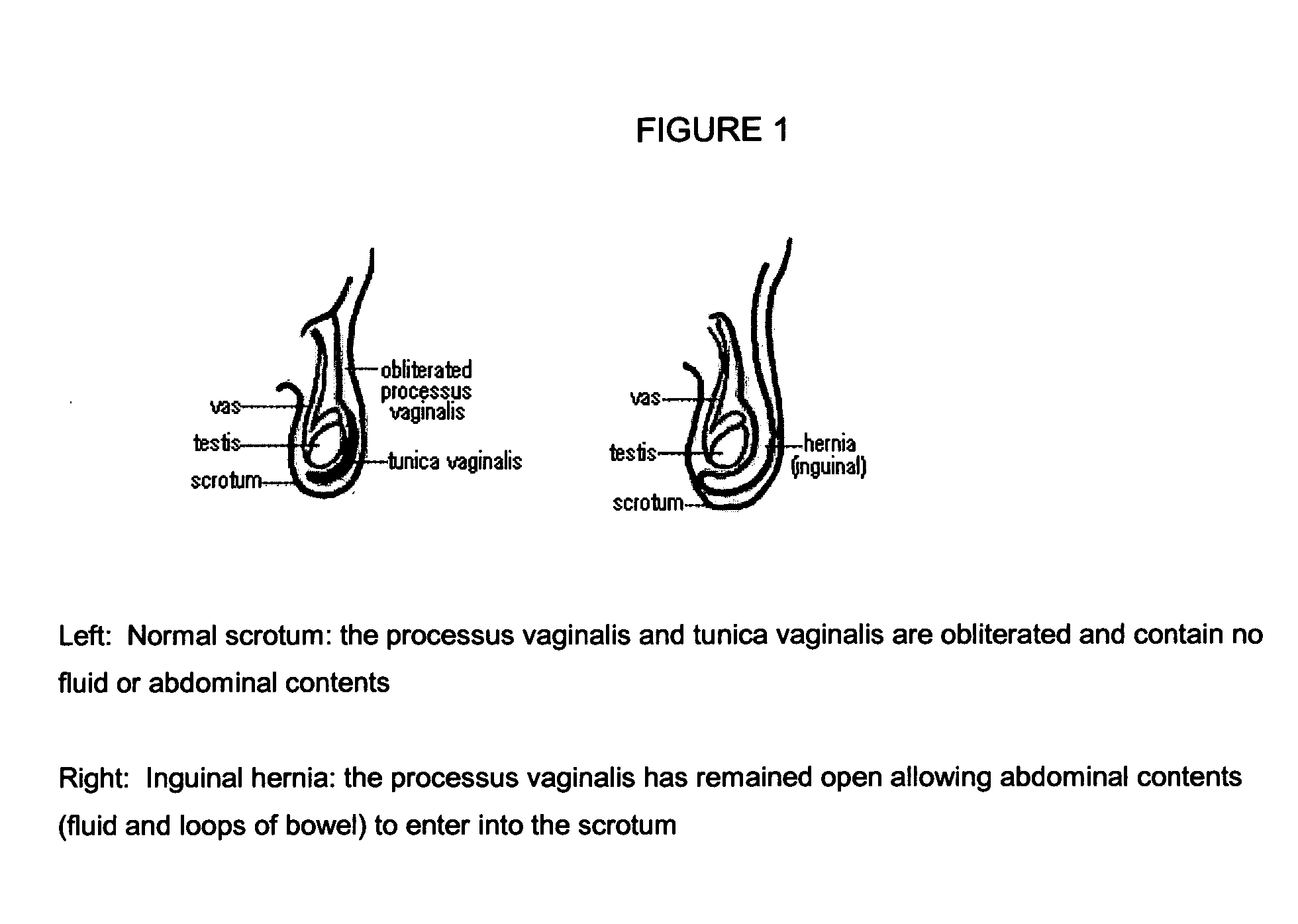 Surgical adhesive and uses therefore