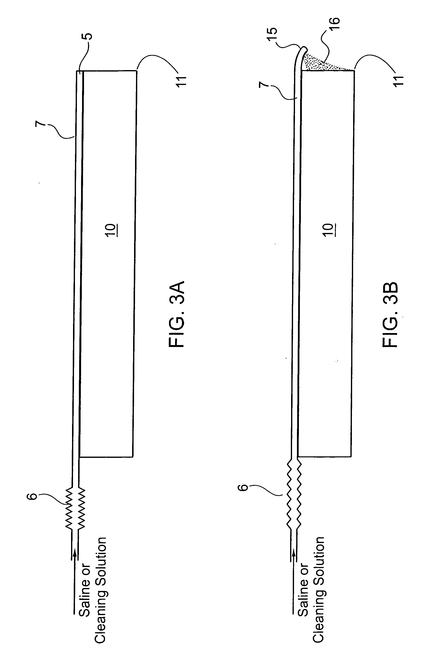 Laparoscope cleaning system