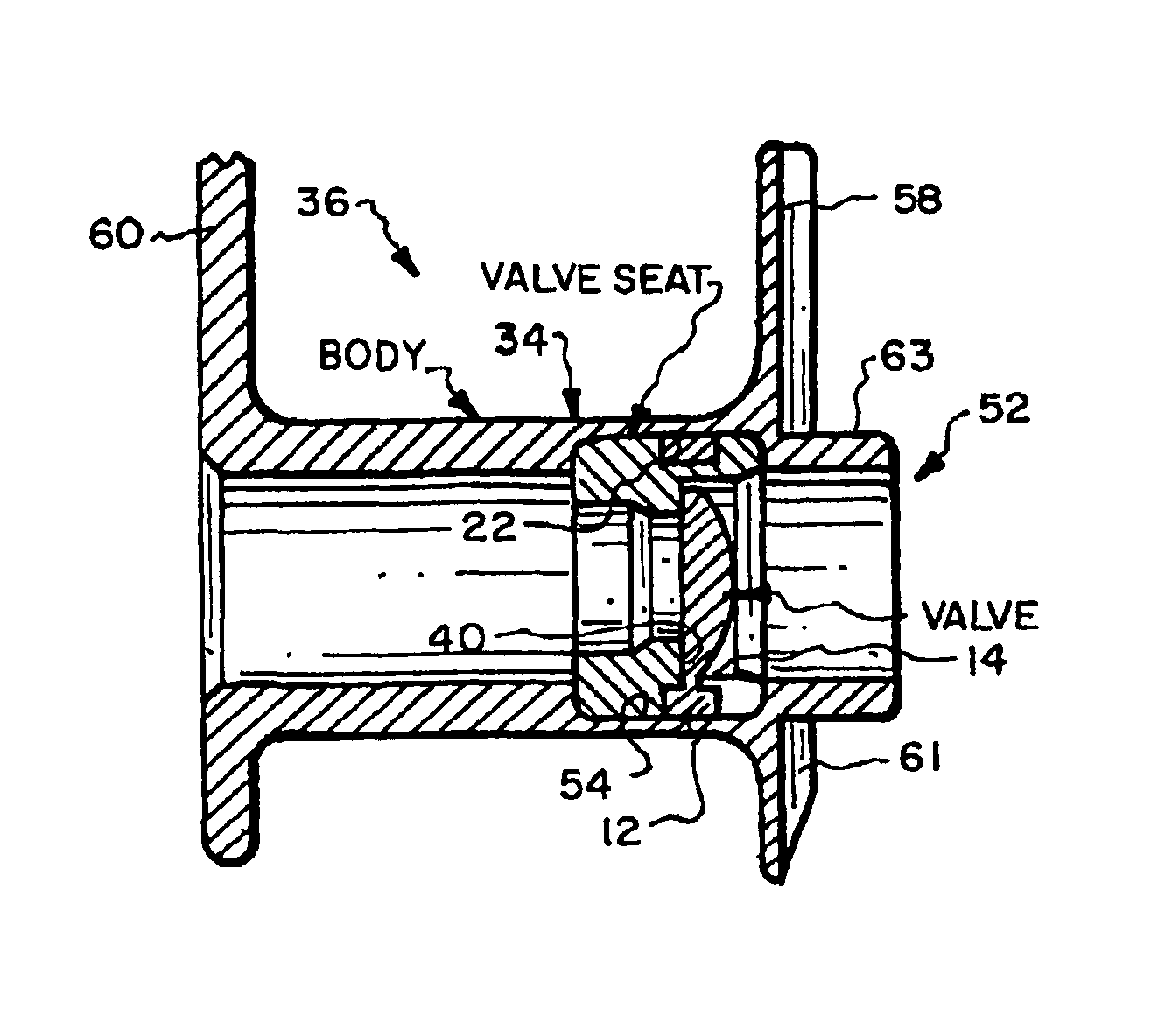 Valve mounting assembly for voice prosthesis-cartridge and ring