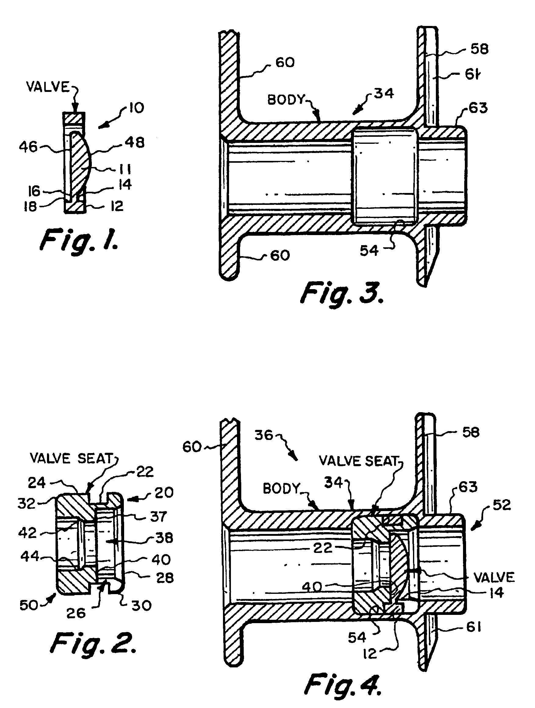 Valve mounting assembly for voice prosthesis-cartridge and ring