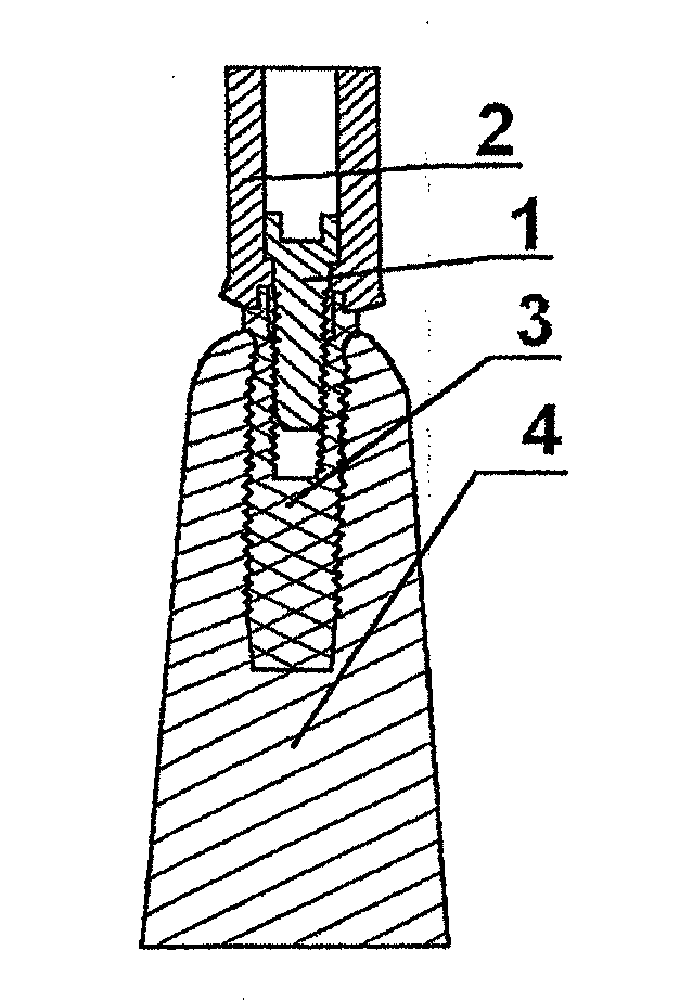 Dental prosthesis