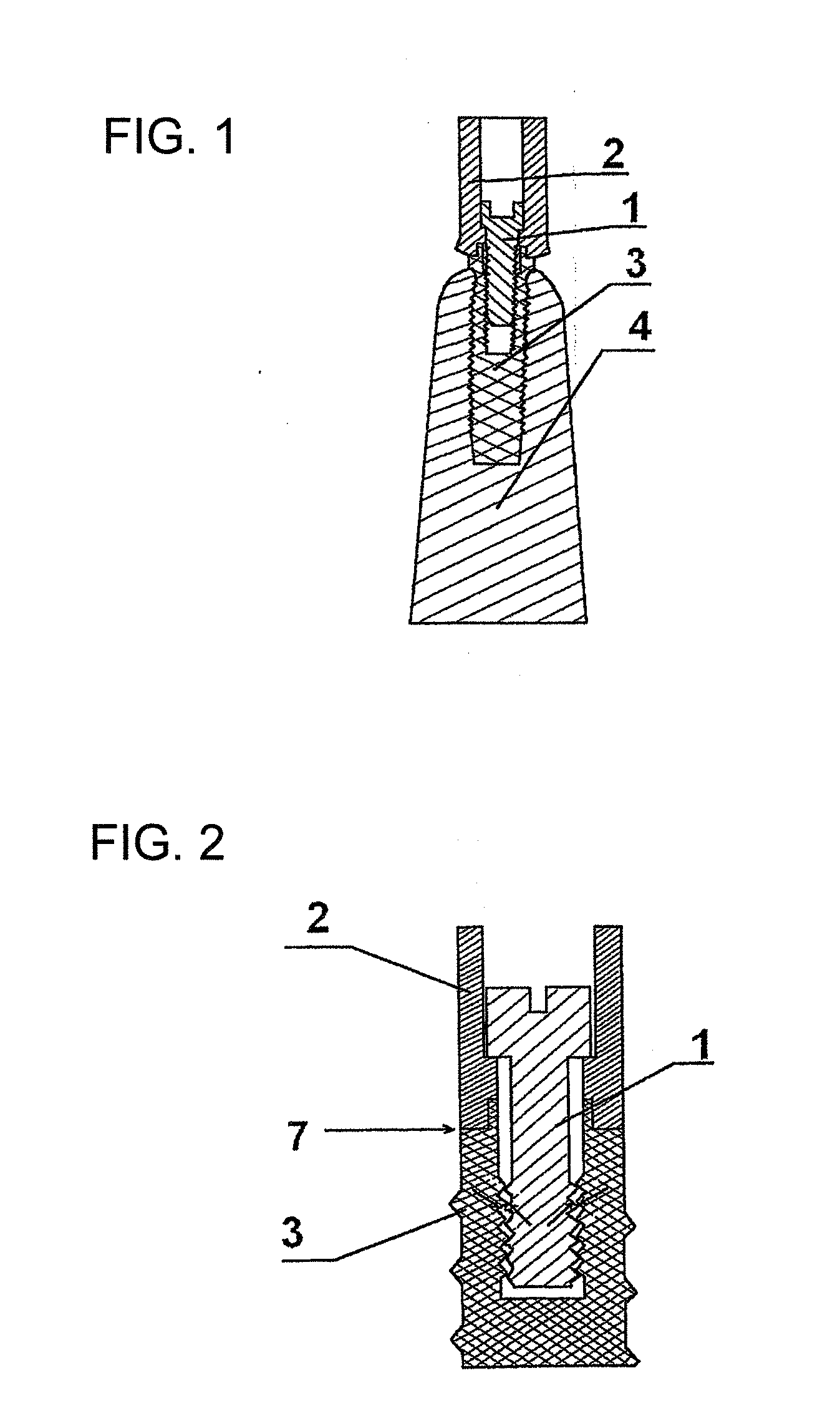 Dental prosthesis