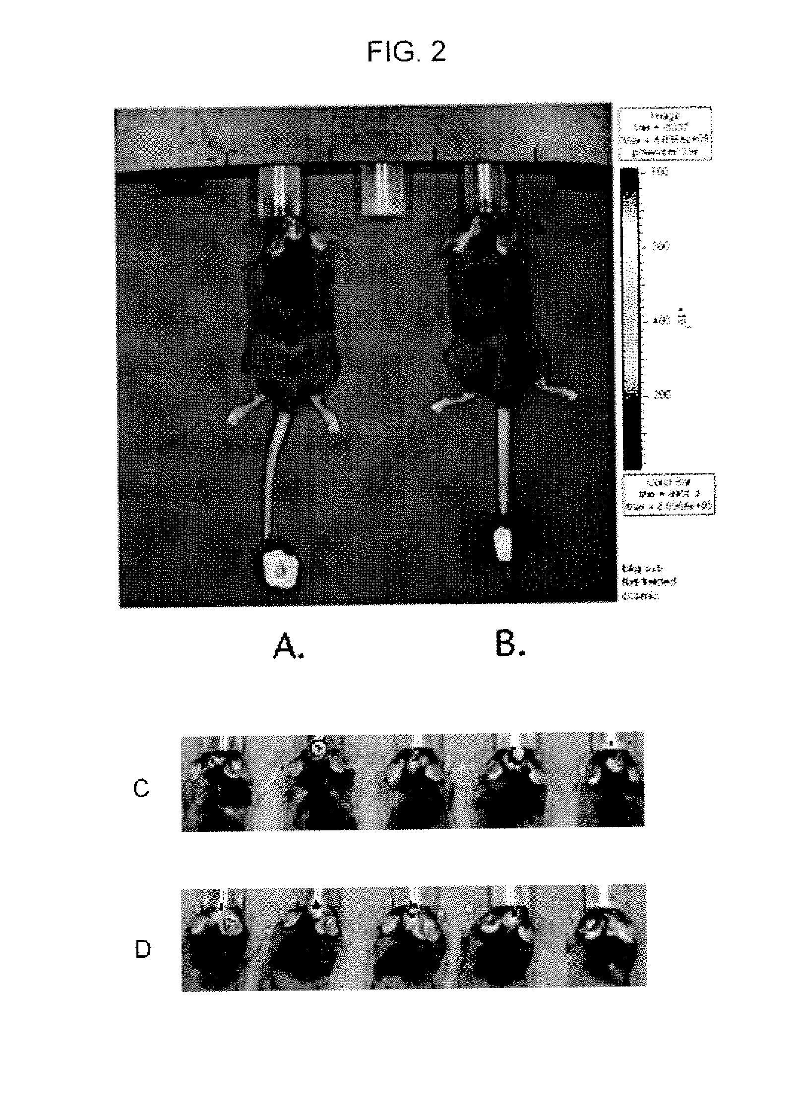 Use of toll-like receptor ligands as adjuvants to vaccination therapy for brain tumors