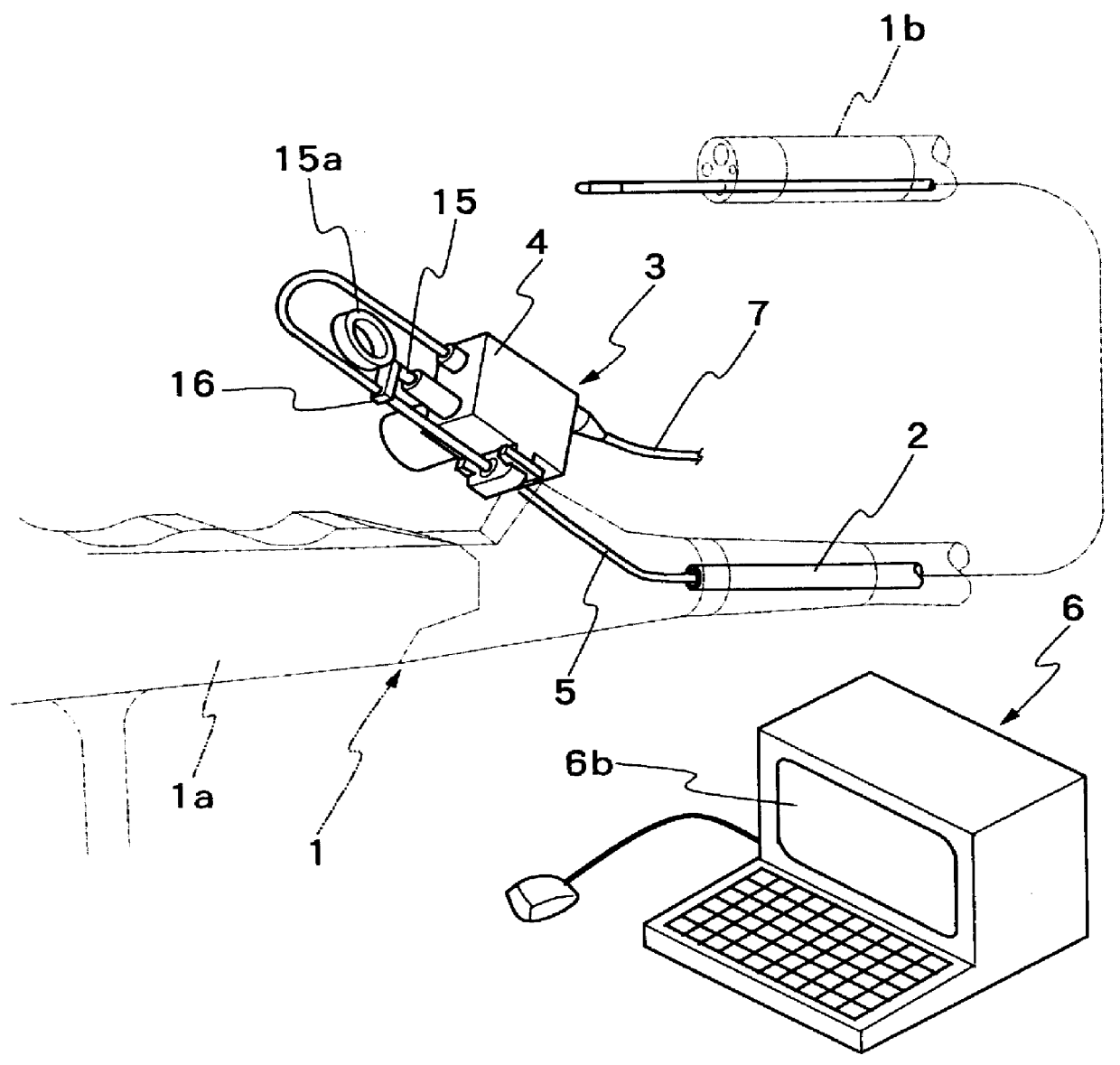 Ultrasound image processing system