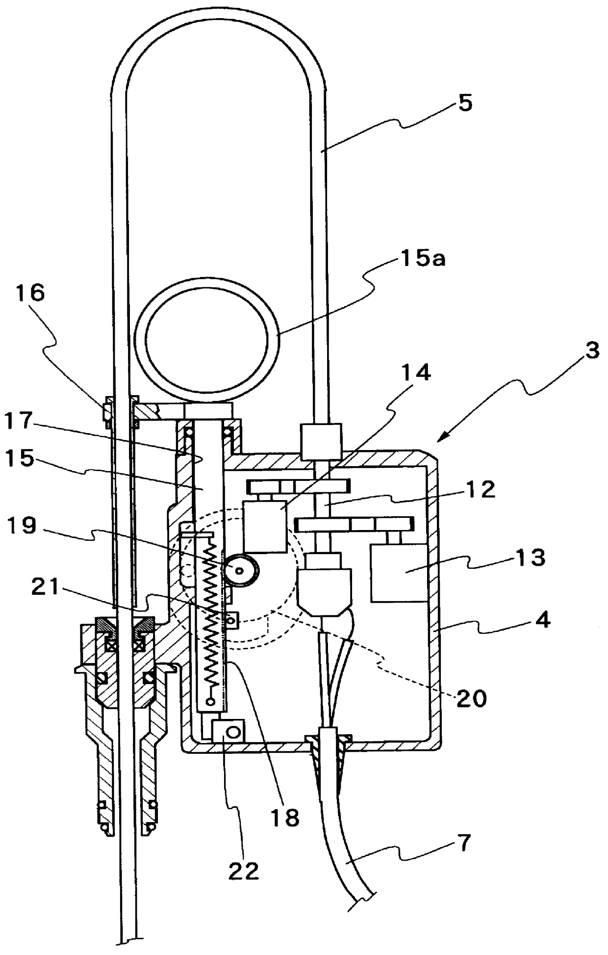 Ultrasound image processing system