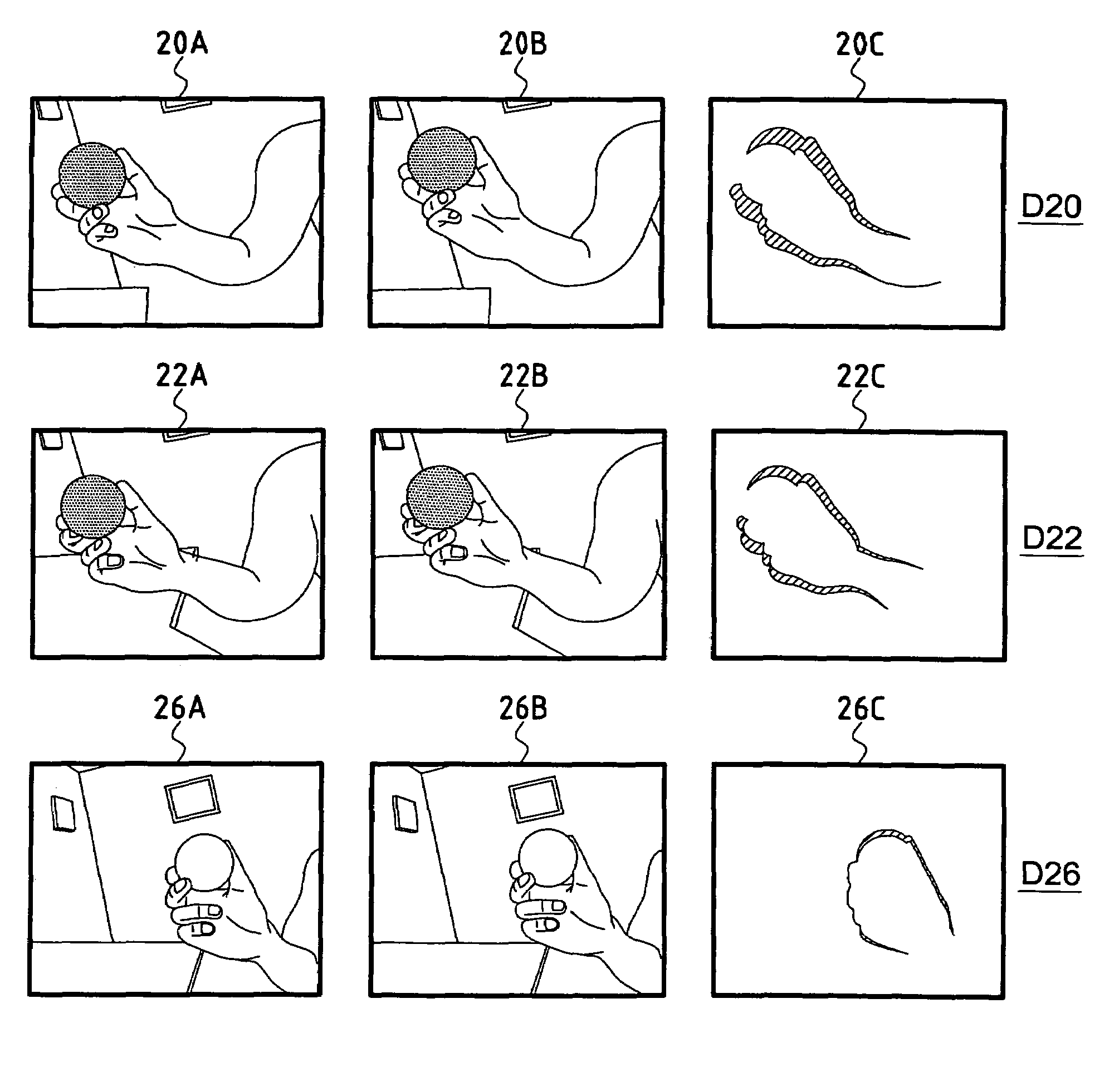 Adaptive artificial vision method and system