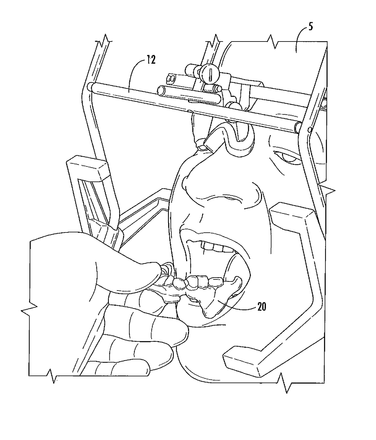 Concussion retarding orthotic and method of producing the orthotic