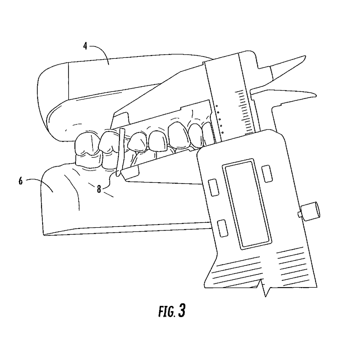 Concussion retarding orthotic and method of producing the orthotic