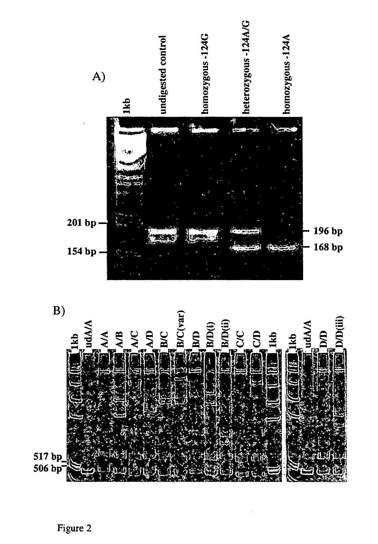 Methods of diagnosis