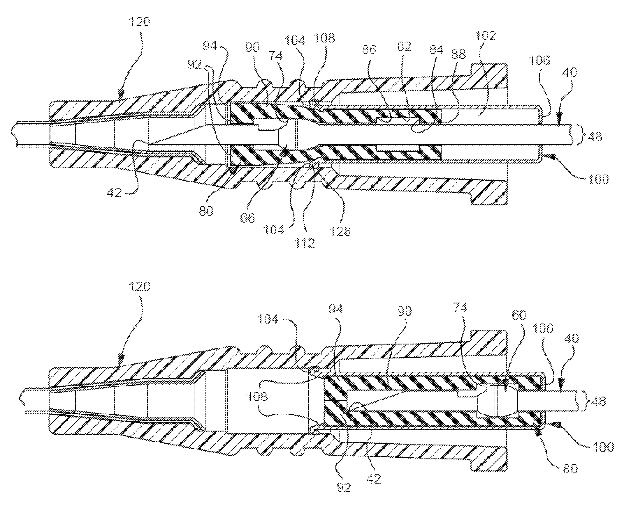 Bi-directional cannula feature capture mechanism