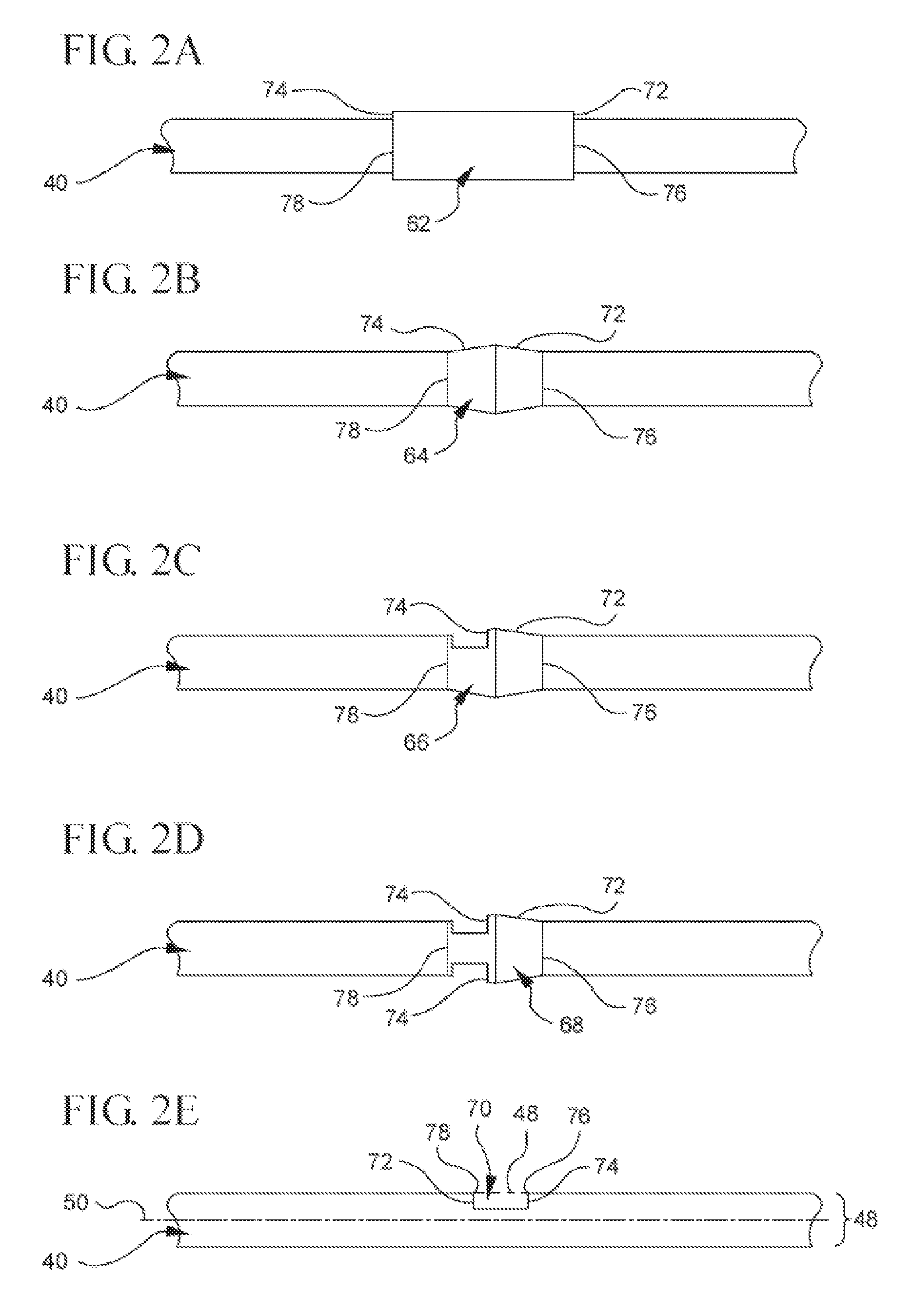 Bi-directional cannula feature capture mechanism