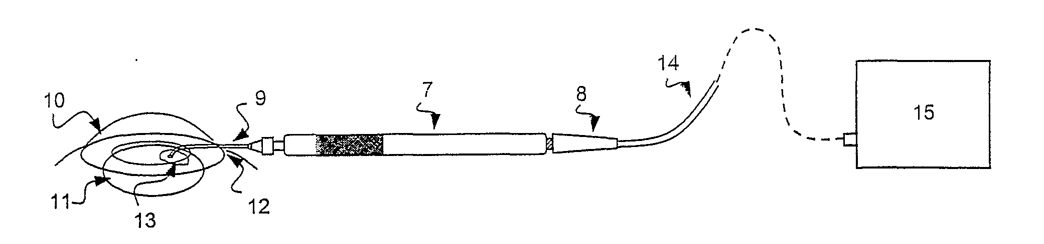 Optical fiber laser device for ocular suturing