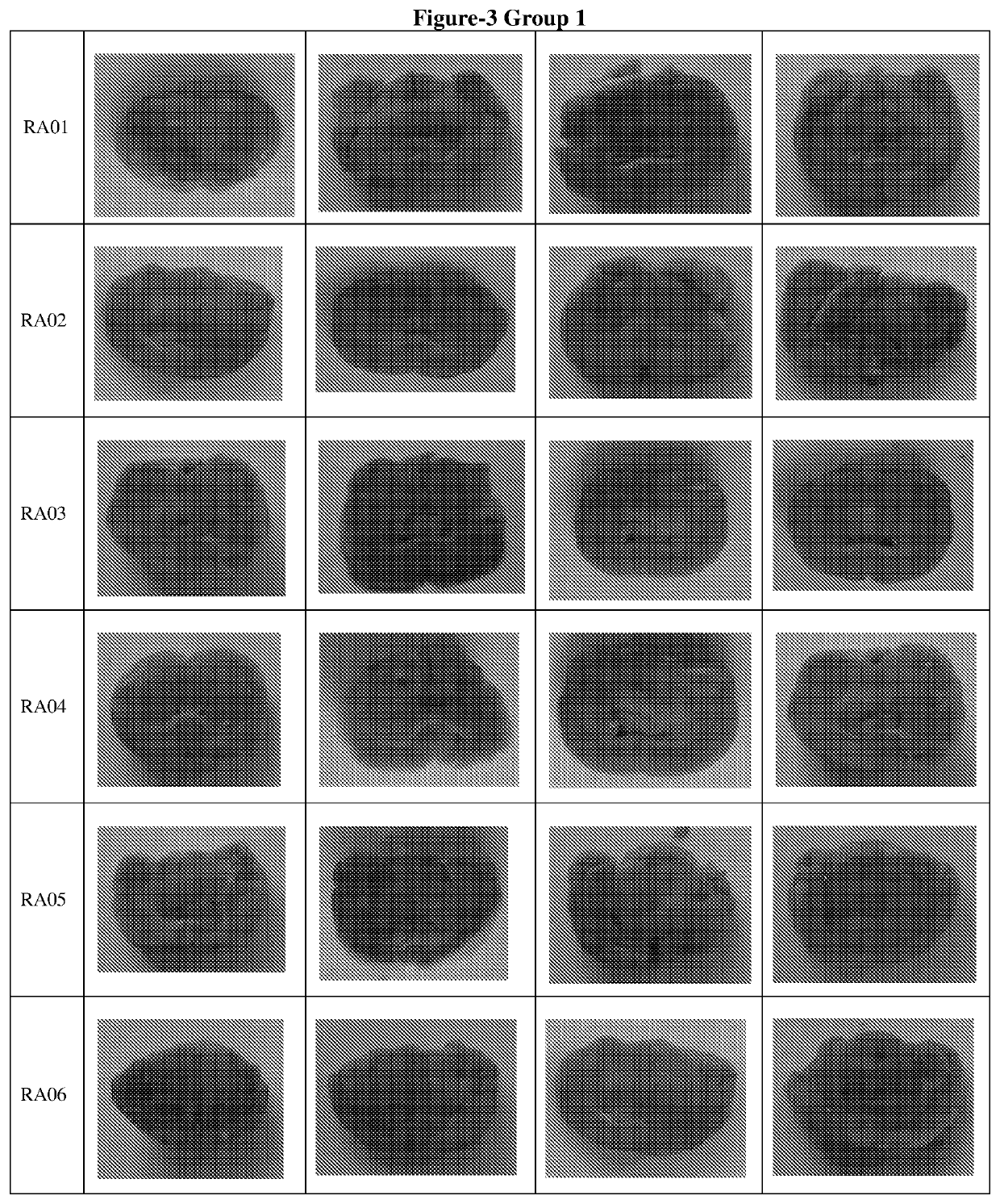 Synergistic bioactive compositions for treating neurological disorders