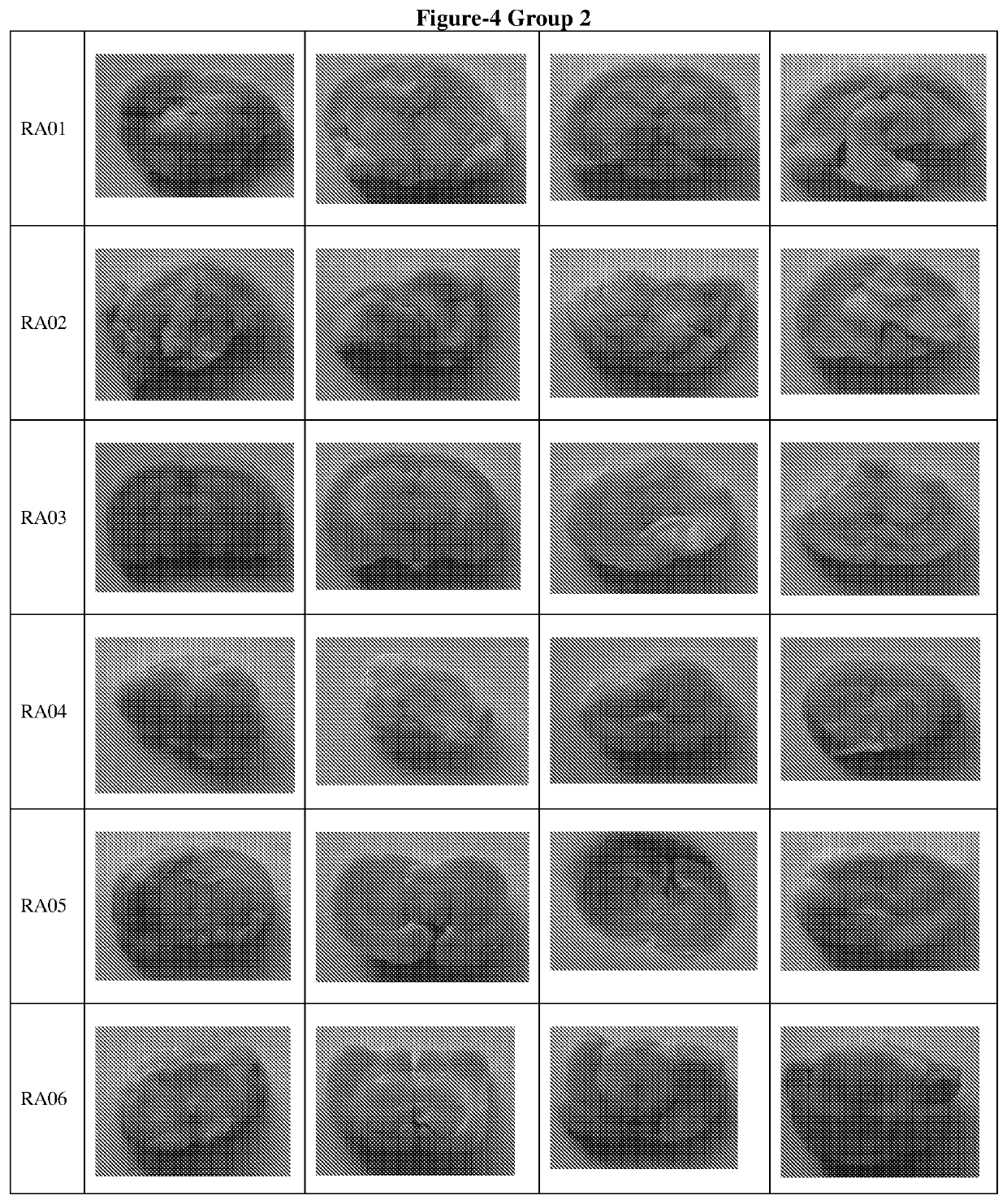 Synergistic bioactive compositions for treating neurological disorders