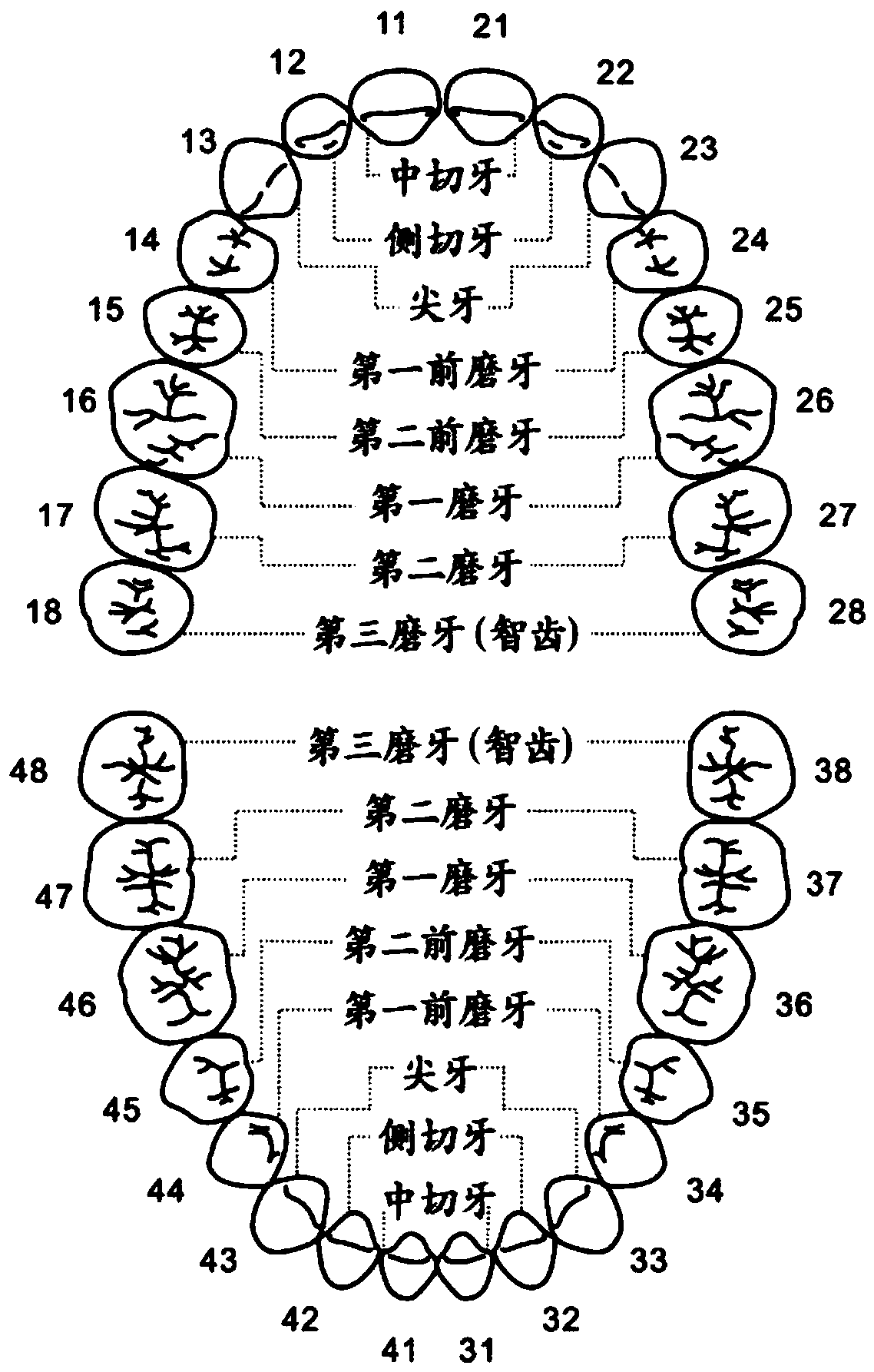 Intelligent recommendation based virtual movable denture design method and system