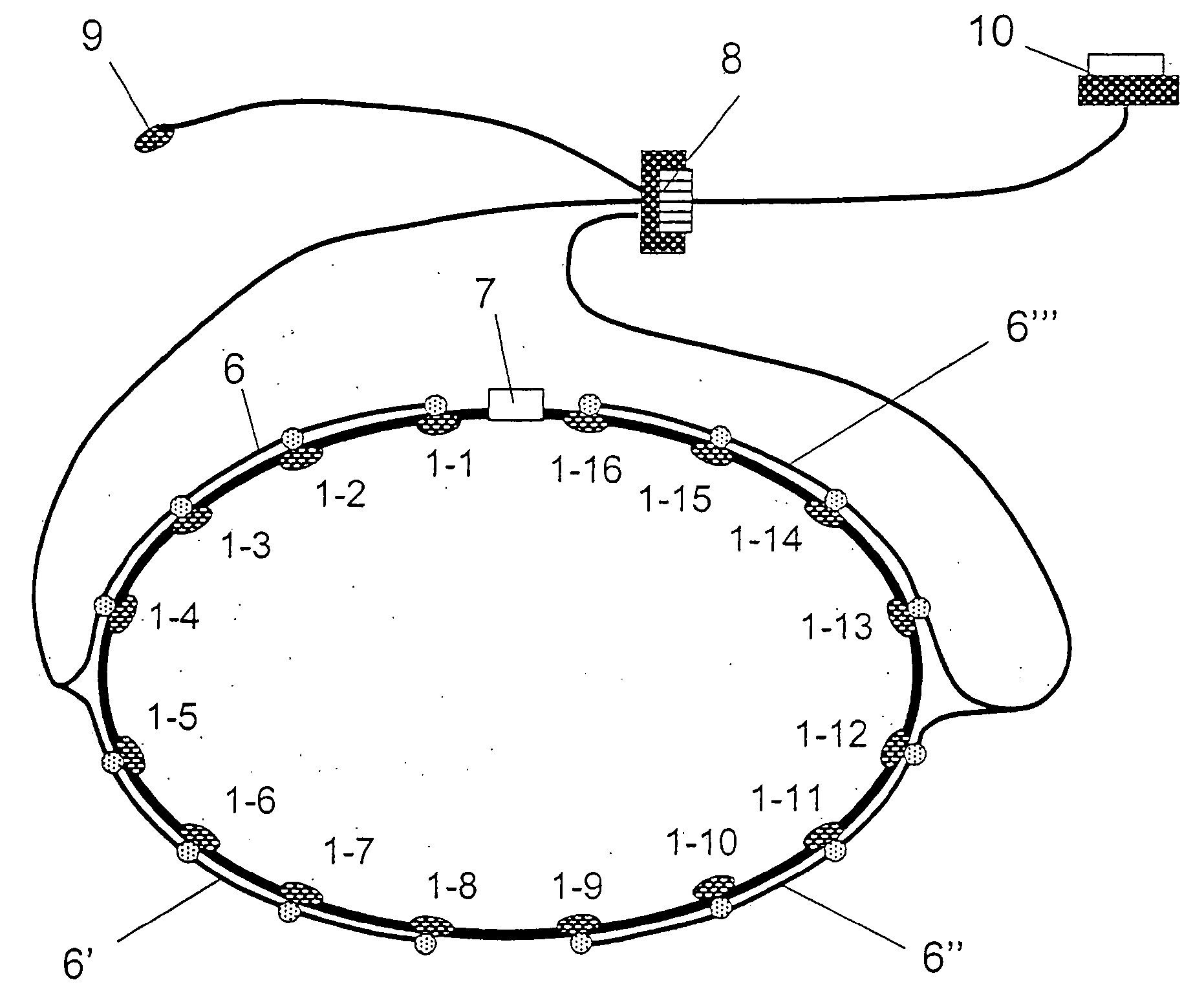 Electrode belt for carrying out electrodiagnostic procedures on the human body