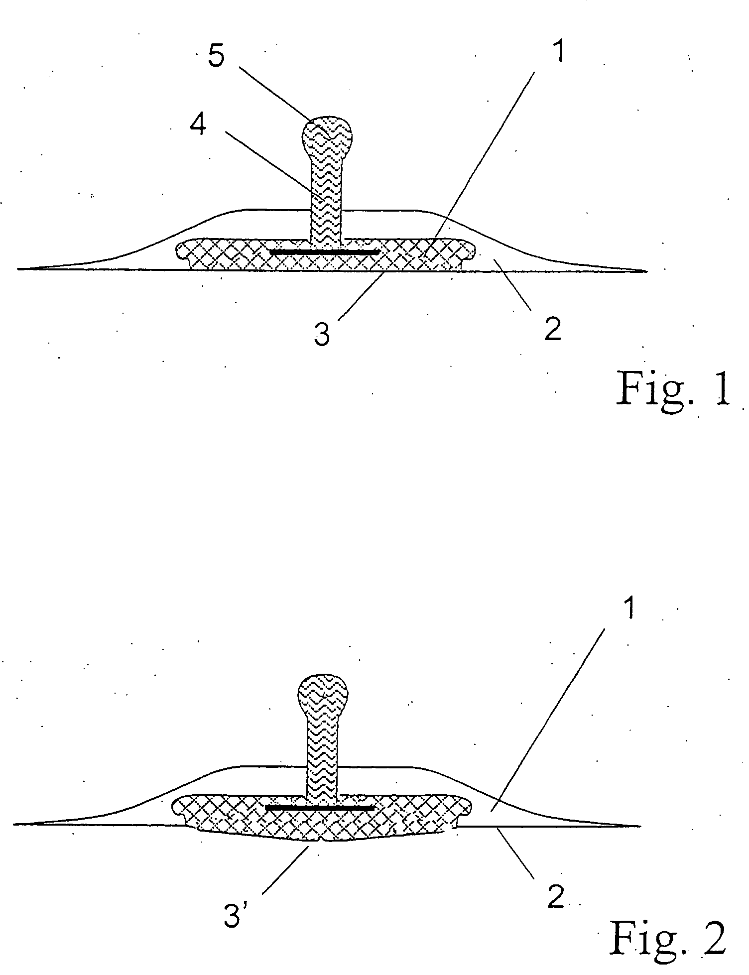 Electrode belt for carrying out electrodiagnostic procedures on the human body