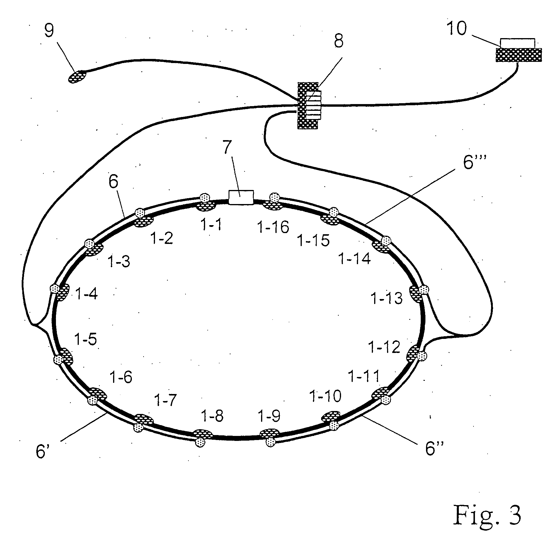 Electrode belt for carrying out electrodiagnostic procedures on the human body