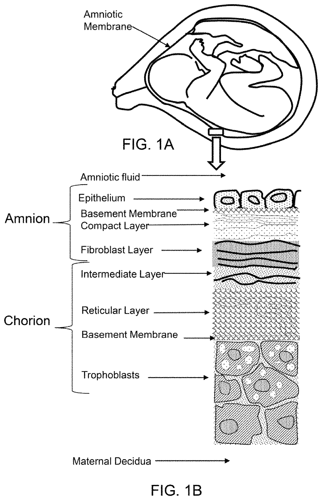 Amnion derived therapeutic compositions and methods of use