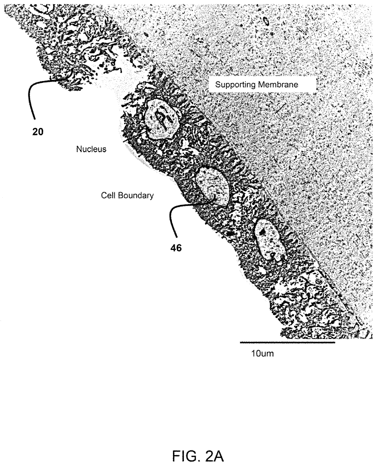 Amnion derived therapeutic compositions and methods of use