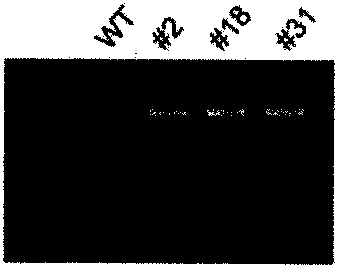 A base editing system, a method, a kit used for specificity repair for human HBB gene mutation and an application therefor