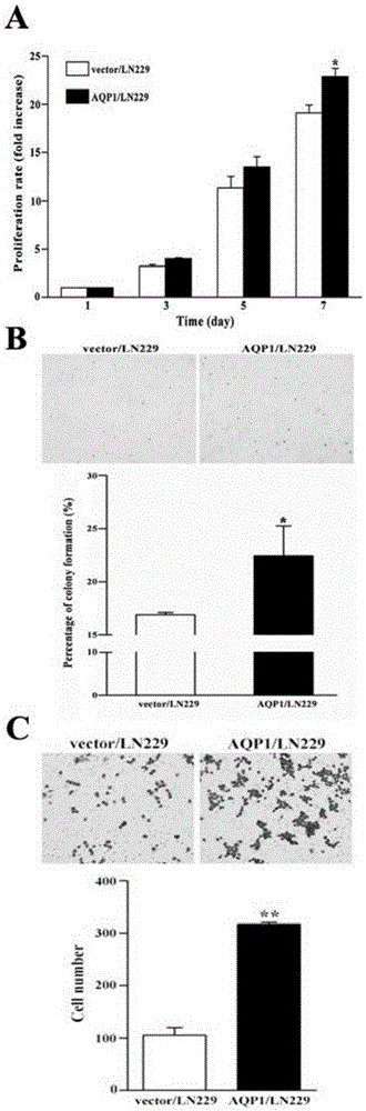 Positive relationship of AQP1 expression and beta-catenin expression