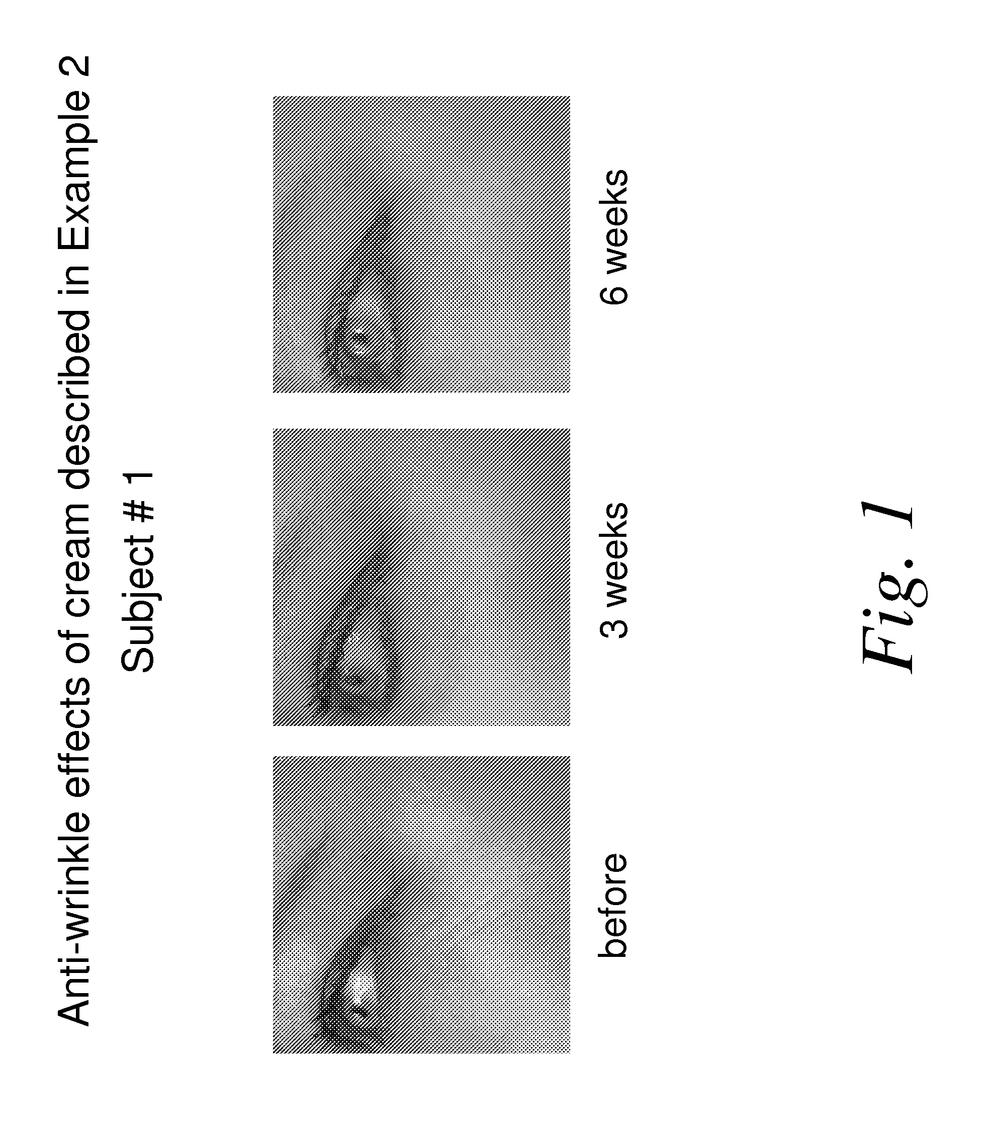 Nicotinamide compositions for treatment of skin diseases and disorders