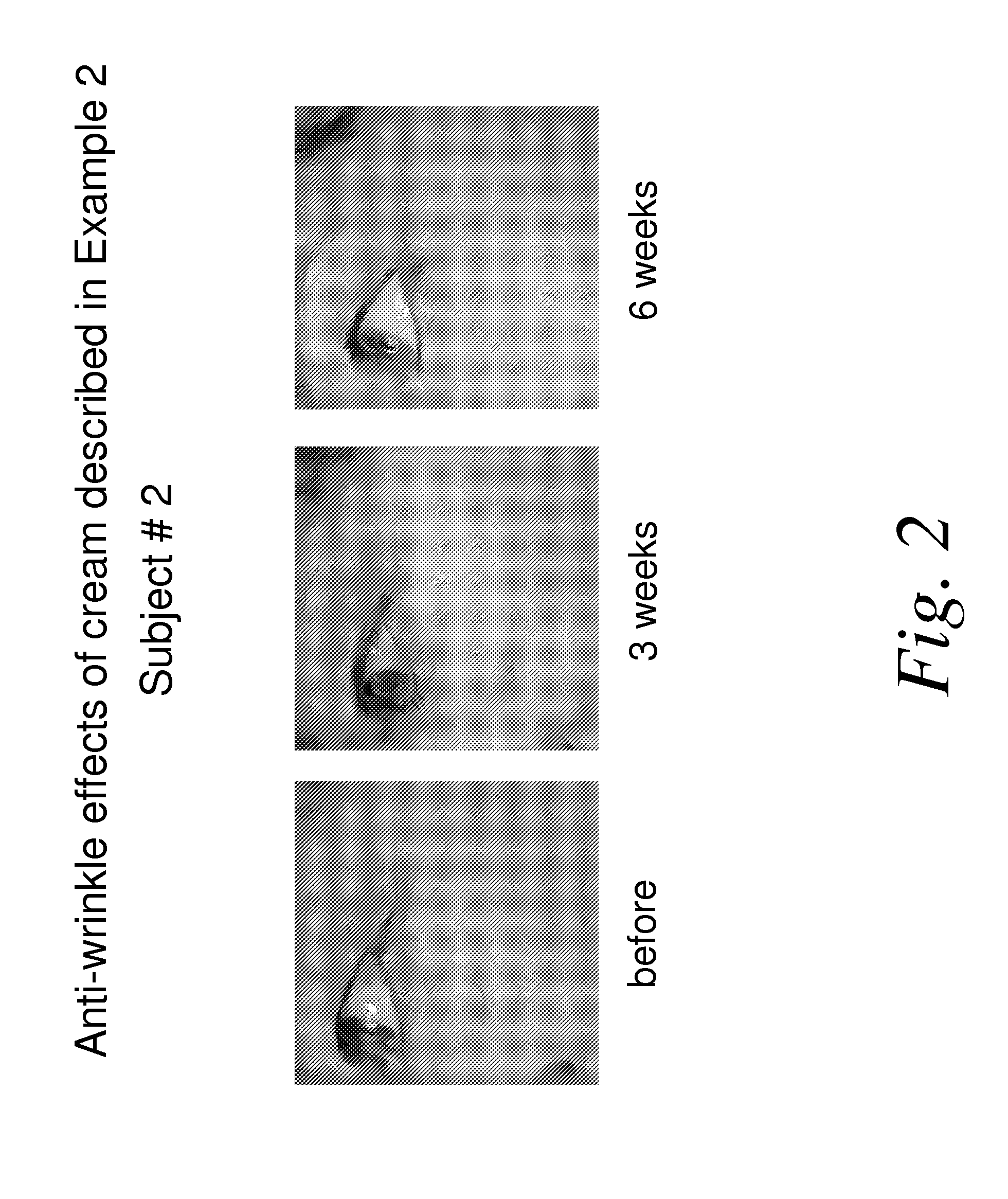 Nicotinamide compositions for treatment of skin diseases and disorders