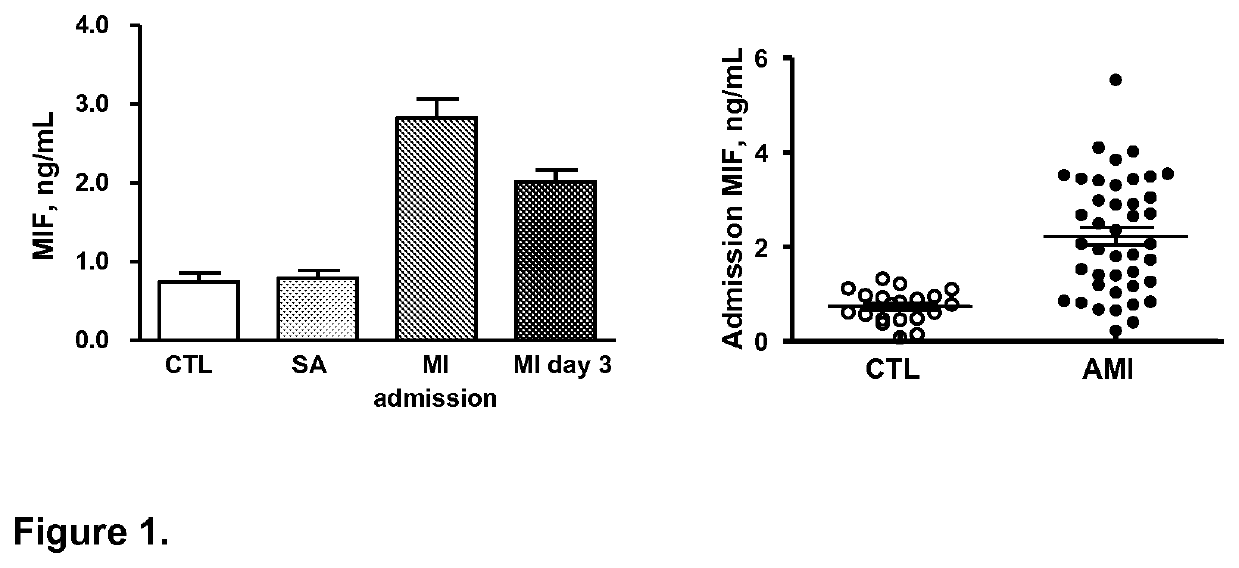 Method for diagnosis, prognosis or treatment of acute coronary syndrome (ACS) comprising measurement of plasma concentration of macrophage migration inhibitory factor (MIF)