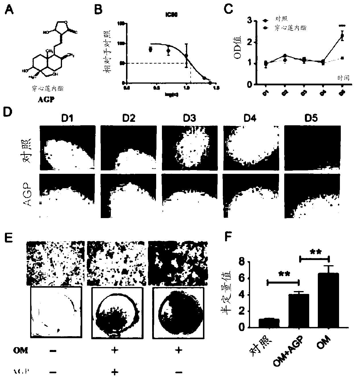 Use of andrographolide in treatment of calcific aortic valve disease