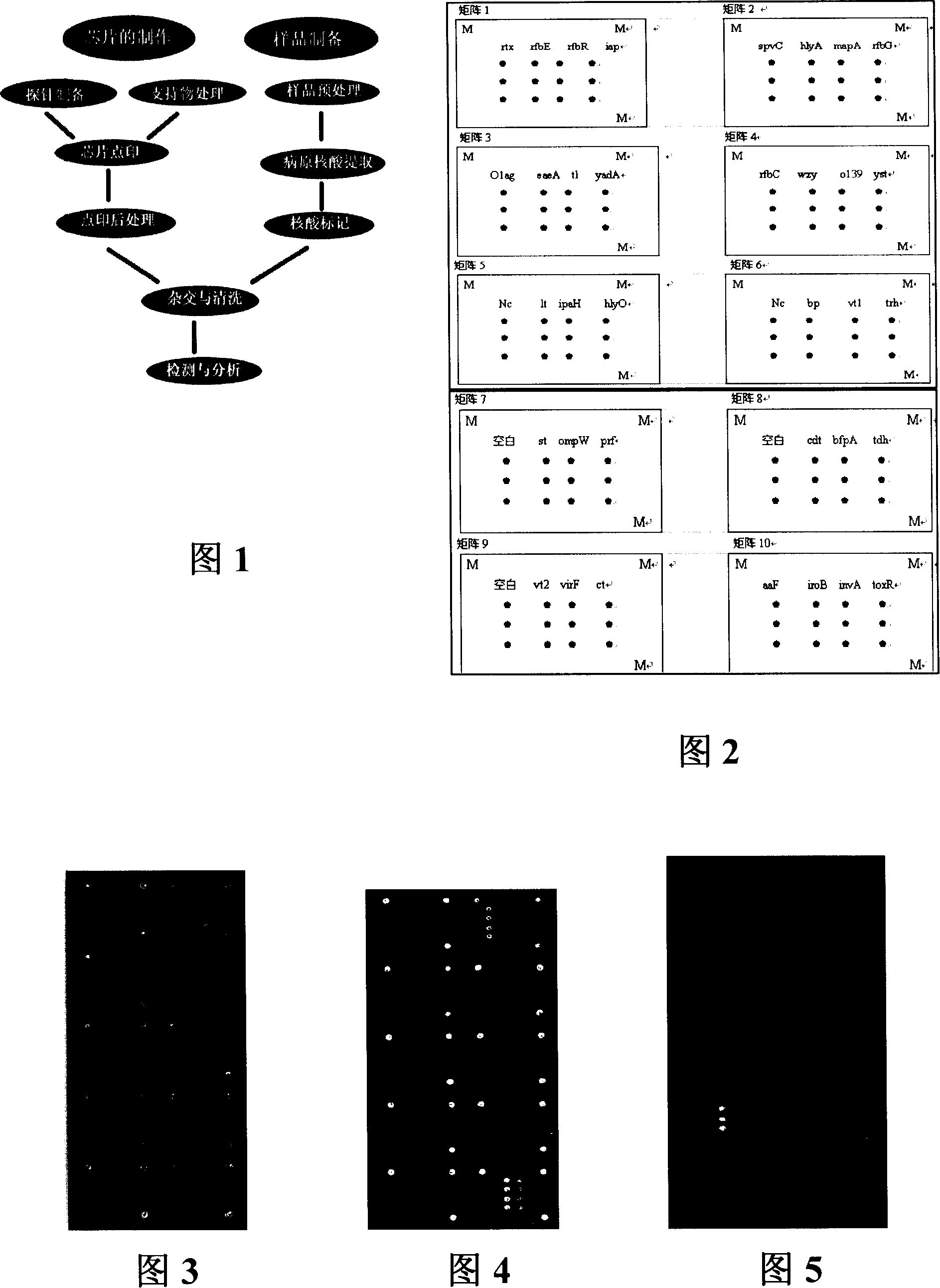 Pathogenic microorganism DNA detecting chip and preparation method and application thereof