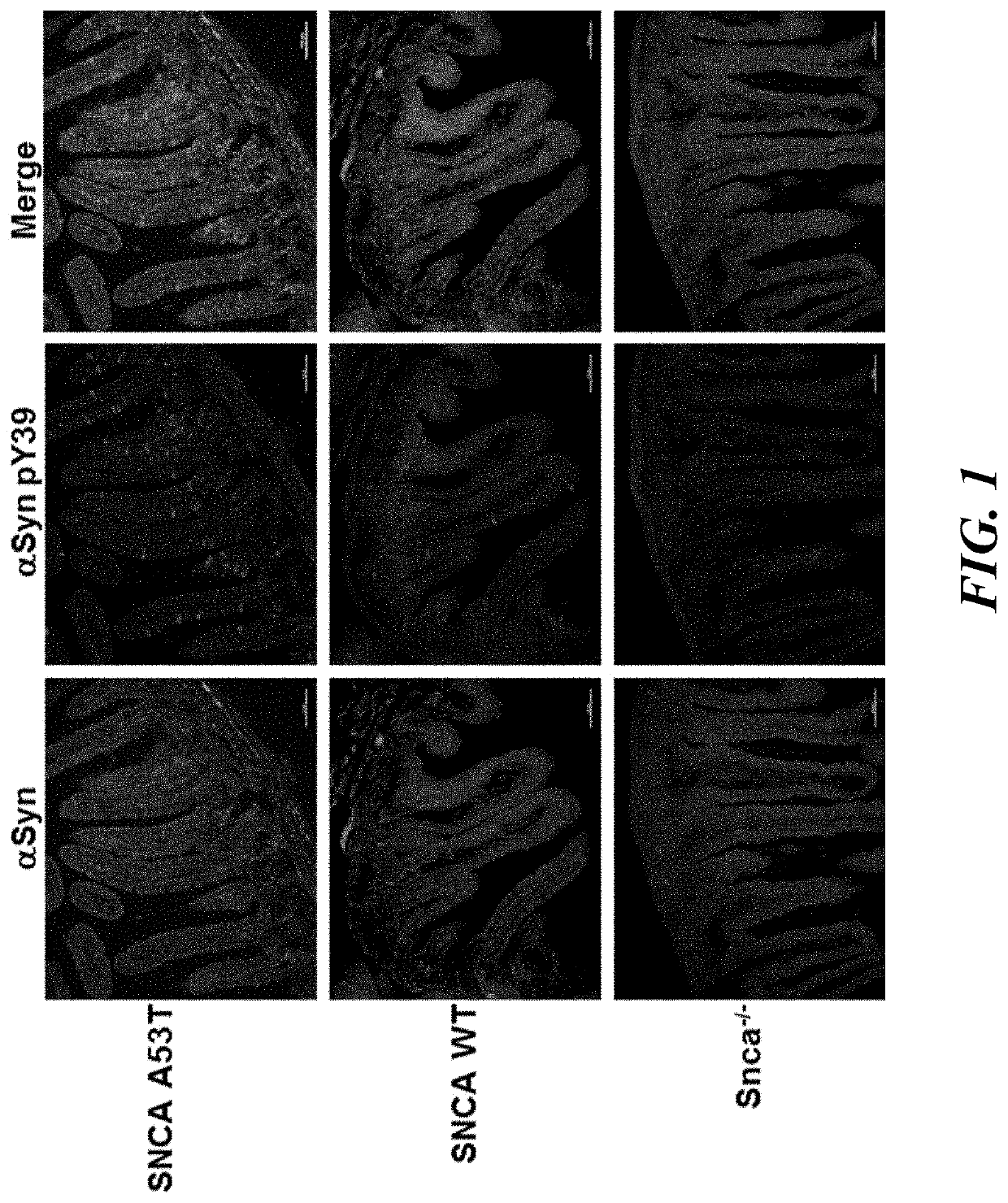 Methods and compositions for evaluation and treatment of synucleinopathies