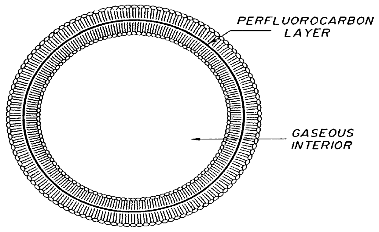 Method of computed tomography using fluorinated gas-filled lipid microspheres as contrast agents