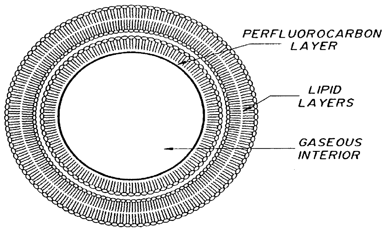 Method of computed tomography using fluorinated gas-filled lipid microspheres as contrast agents